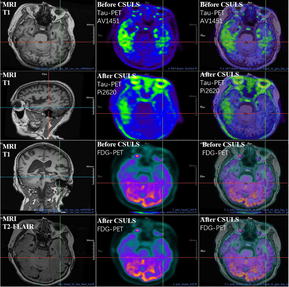 300多家医院抢着做的手术,为何突被禁?
